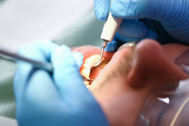 Best Emergency Dental Care for Broken or Chipped Teeth in Sharon, WI