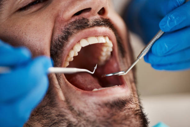 Best Emergency Denture Repair in Sharon, WI